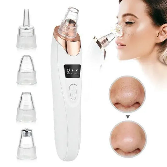 Electric Blackhead Remover Vacuum with 5 Interchangeable Suction Heads