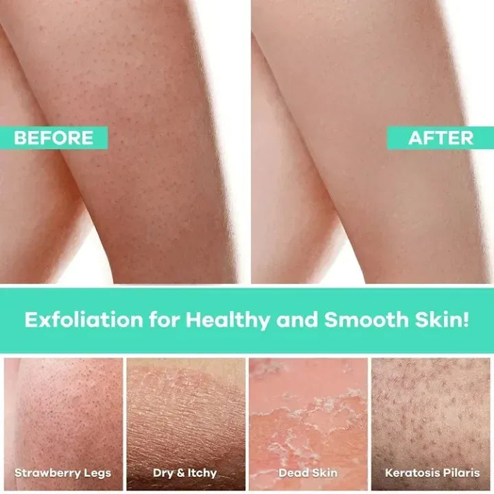 2 Pcs Korean Exfoliating Gloves | Body Peeling Dead Skin Remover