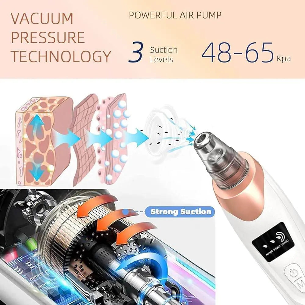 Electric Blackhead Remover Vacuum with 5 Interchangeable Suction Heads