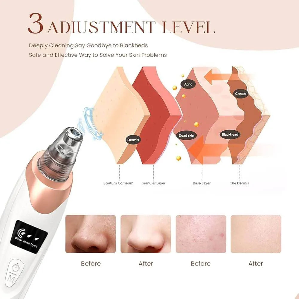 Electric Blackhead Remover Vacuum with 5 Interchangeable Suction Heads